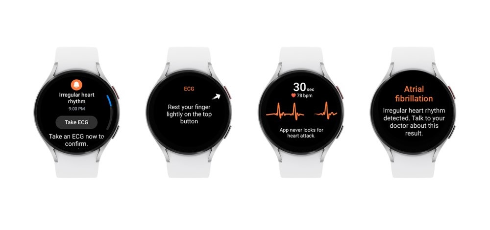 Galaxy Watch kommer varna för oregelbunden hjärtrytm