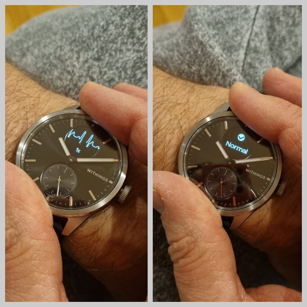 Withings ScanWatch 2 5 Withings EKG matning
